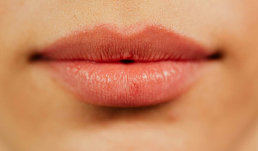 Healthy Kissable Lips